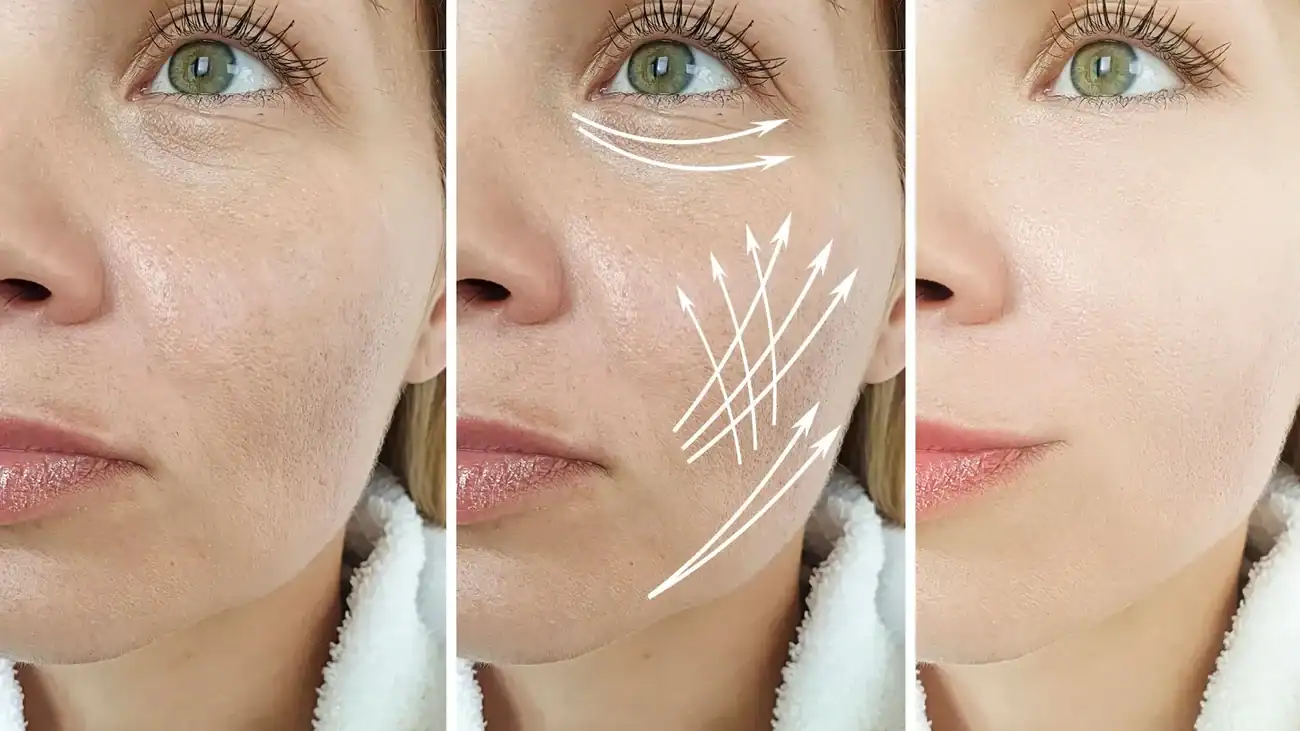 Can One Treatment Really Tackle More Than One Skin Concern Bridgwater?
