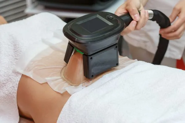 Image of person having fat freezing treatment to help weight gain Bridgwater