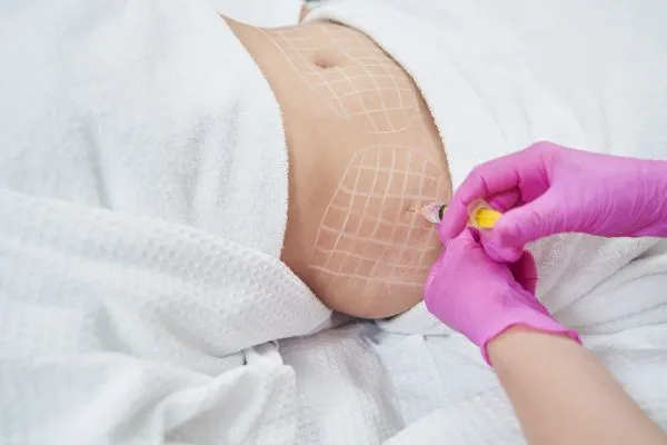 image of fat dissolving injections on love handles to help combat weight gain Bridgwater