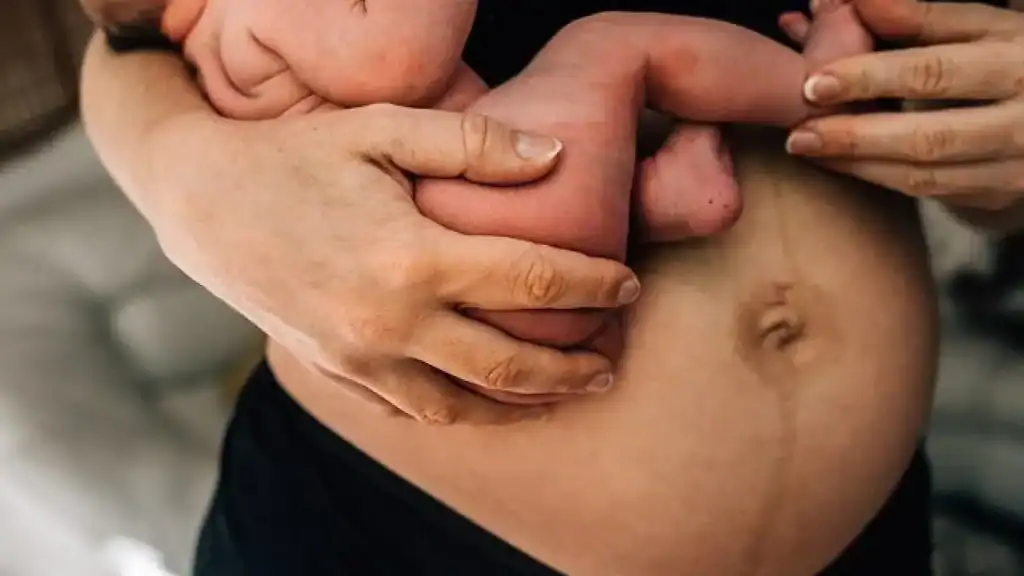 Why Is My Stomach Still Big After Pregnancy Bridgwater?